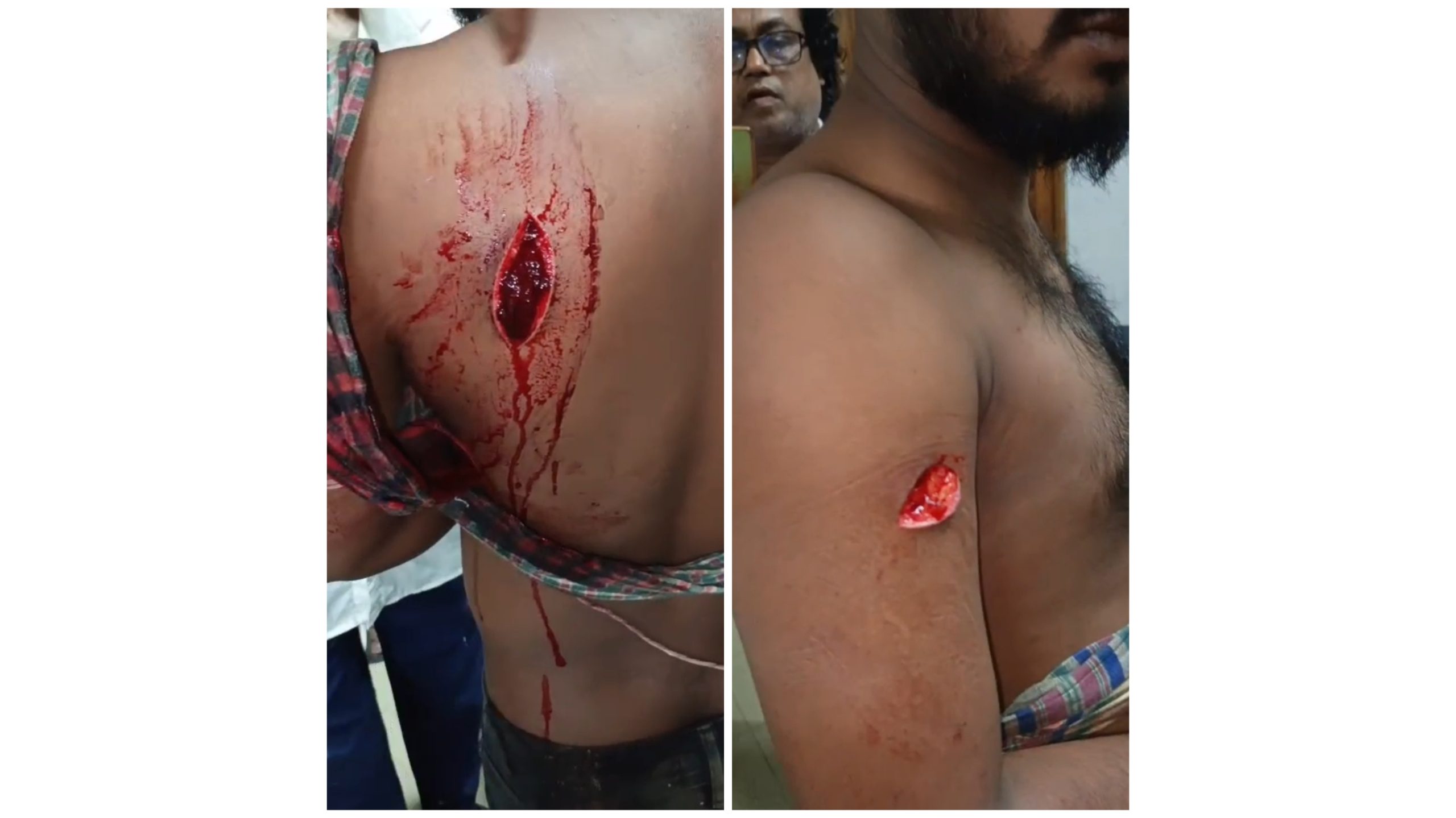 দোয়ারাবাজারে পূর্ব শত্রুতার জেরে যুবকের ওপর হামলা, থানায় লিখিত অভিযোগ